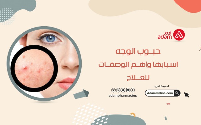 حبوب الوجه واسبابها وأهم الوصفات للعلاج